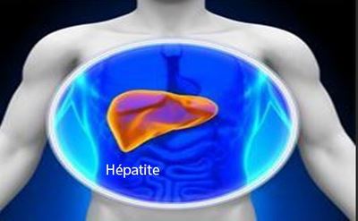 Lire la suite à propos de l’article Testé positif de l’Hépatite B Chronique : Hépatite B Remède et Conduite à Tenir