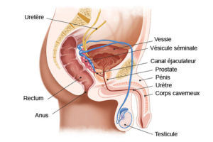Prostatite appareil-urogenital-homme