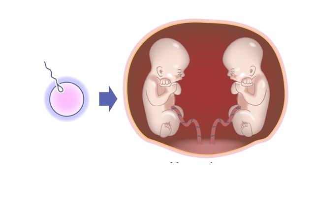 Lire la suite à propos de l’article Comment Tomber Enceinte de Jumeaux ? Comment Faire des Jumeaux ?