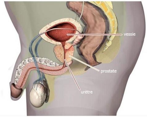 Lire la suite à propos de l’article Cancer Prostate Solution Naturelle Par les Plantes