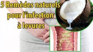 Lire la suite à propos de l’article Remède Naturel Contre Les Infections À Levures, Infection À Levures