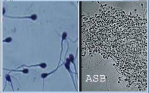 Lire la suite à propos de l’article L’Asthenozoospermie: Traitement naturel contre l’Asthenozoospermie