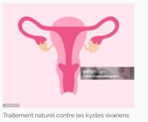 Lire la suite à propos de l’article Kystes ovariens : Traitement naturel contre les kystes ovariens