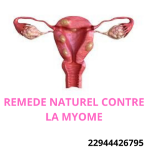 Lire la suite à propos de l’article Causes de la myome : Remède naturel contre la myome