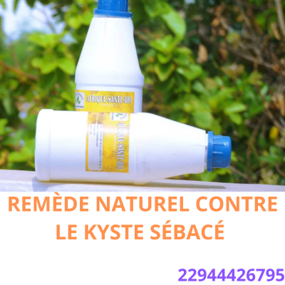 Lire la suite à propos de l’article Causes du kystes Sébacé : Remède naturel contre le kyste Sébacé